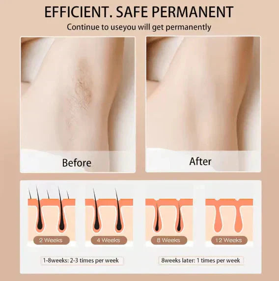 Babyverse - Digital IPL Hair Removal Device GIBBS
